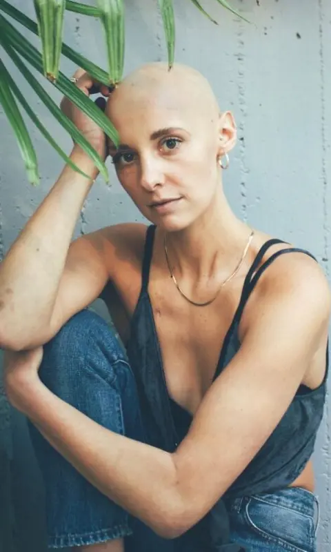 Photo of cancer patient with no hair in jeans and tank top posing for portrait